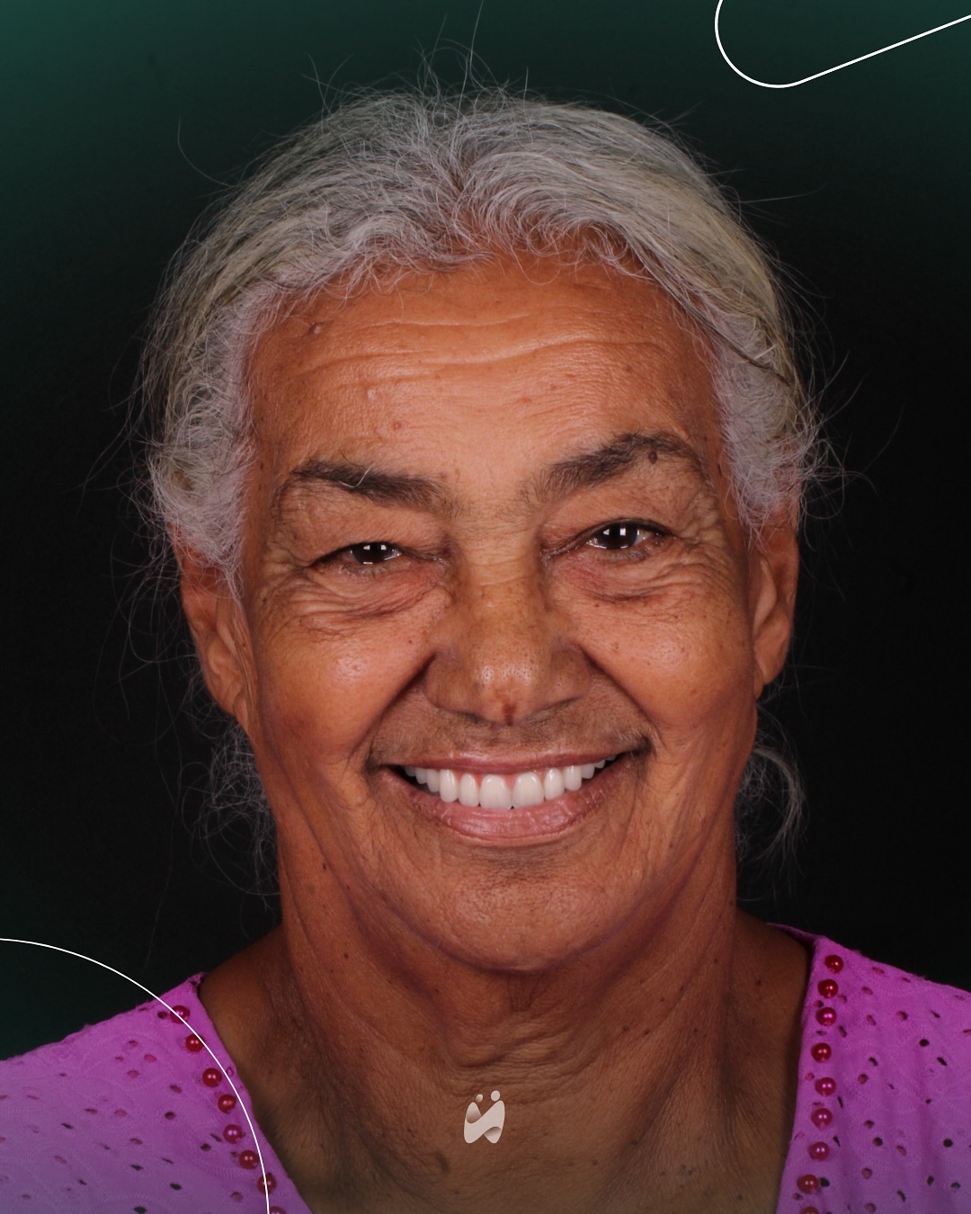 Caso 3 — depois